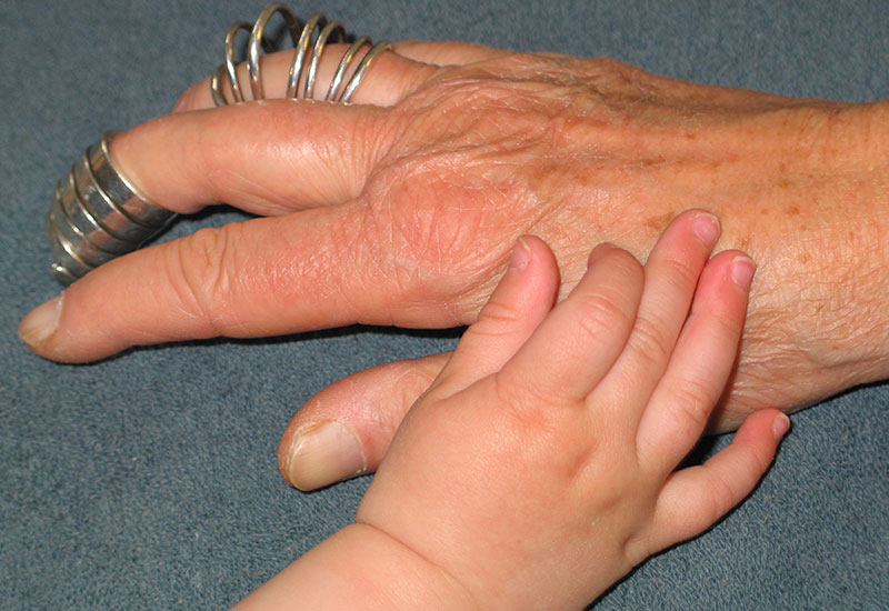 Neurologie Geriatrie Demenz